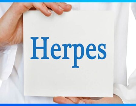 Herpes genital
