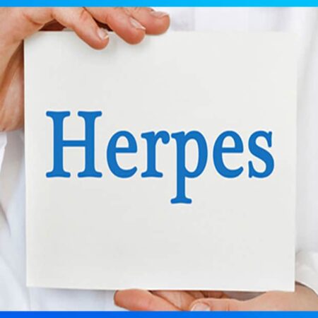 Herpes genital