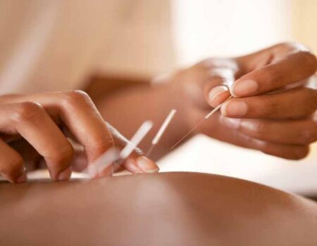 Es-la-acupuntura-adecuada-para-usted
