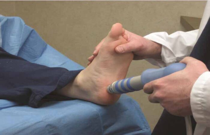 Fascitis-plantar-Causas,-Síntomas-y-Tratamiento