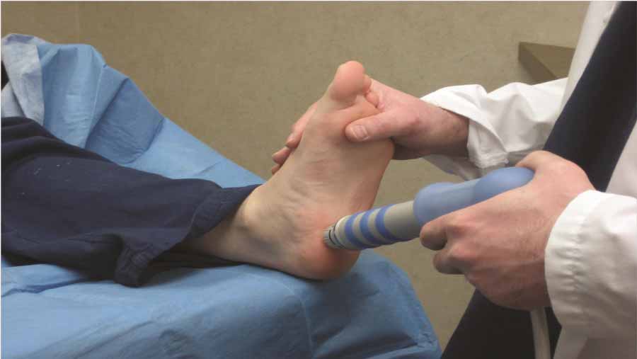 Fascitis-plantar-Causas,-Síntomas-y-Tratamiento