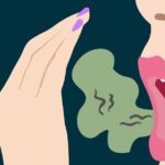 Halitosis---Causas-y-Tratamiento