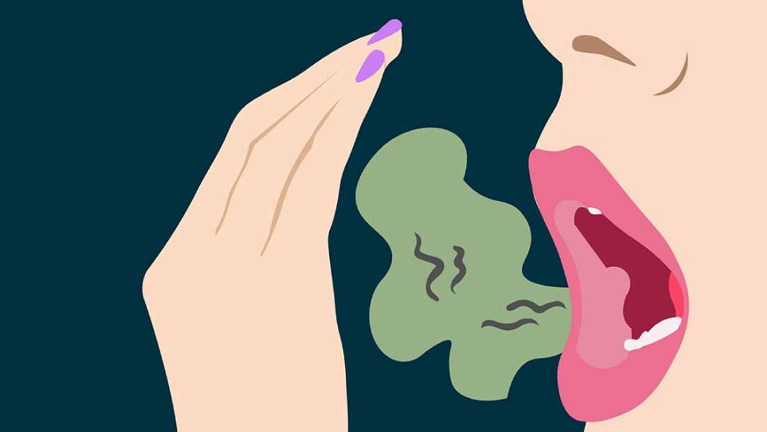 Halitosis---Causas-y-Tratamiento